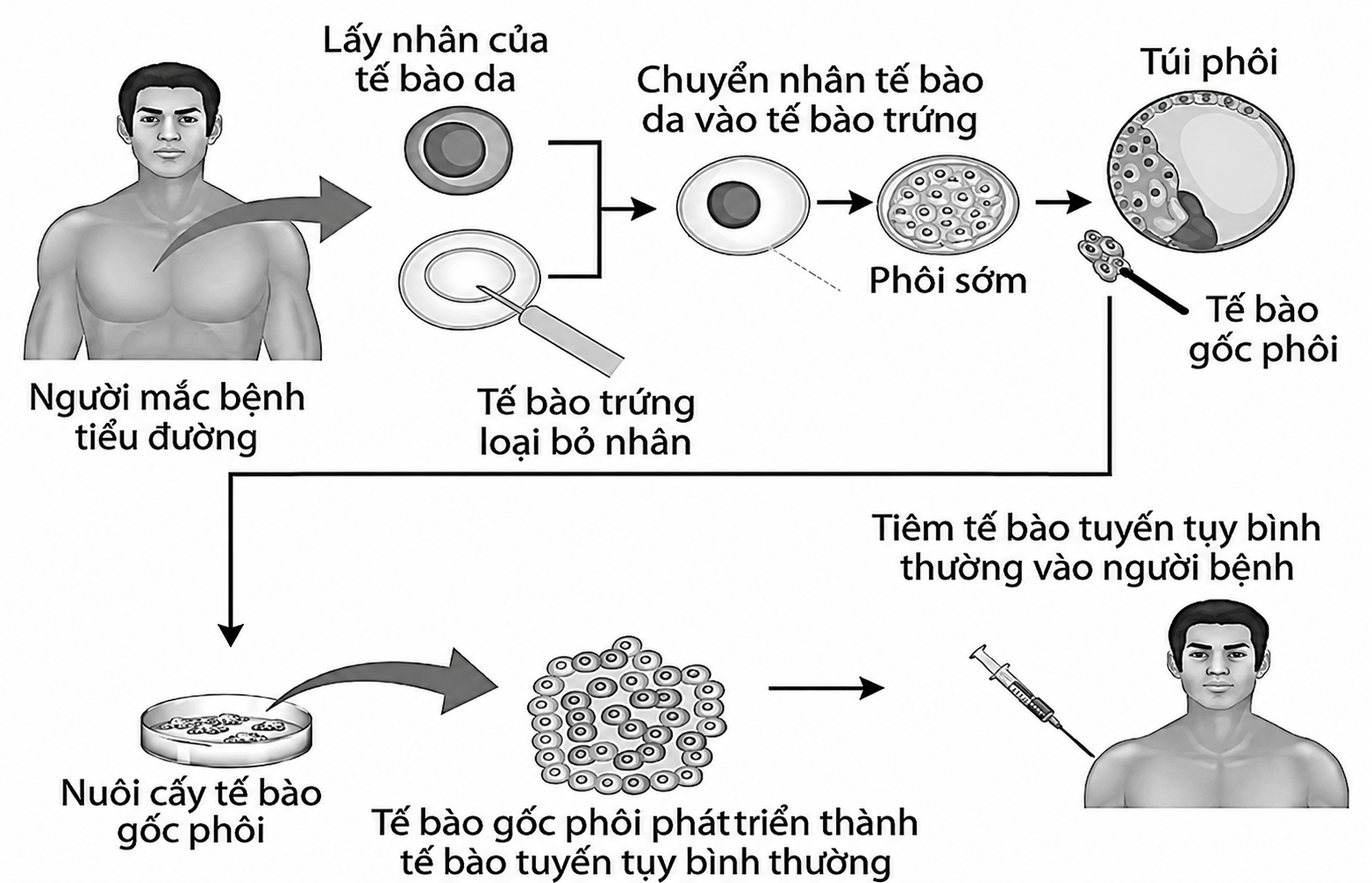 Hình minh họa