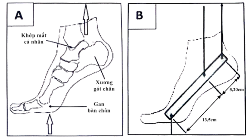 Hình ngữ liệu